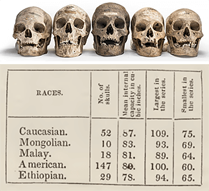 Skulls from the collection of Morton, illustrate his classification of people into five races.